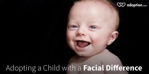 Adopting a Child with a Facial Difference